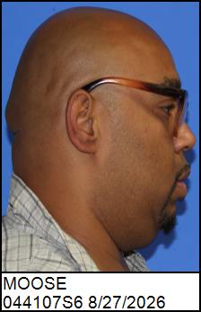 Right Profile