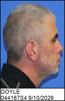 Right Profile