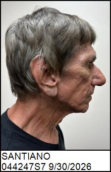 Right Profile