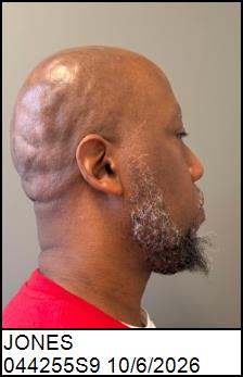 Right Profile